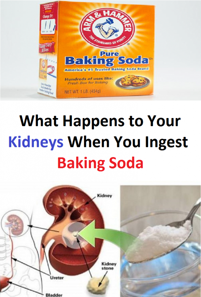 What happens to your kidneys when you ingest baking soda