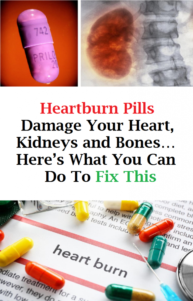 Heartburn Pills Damage Your Heart, Kidneys and Bones…Here’s What You Can Do To Fix This
